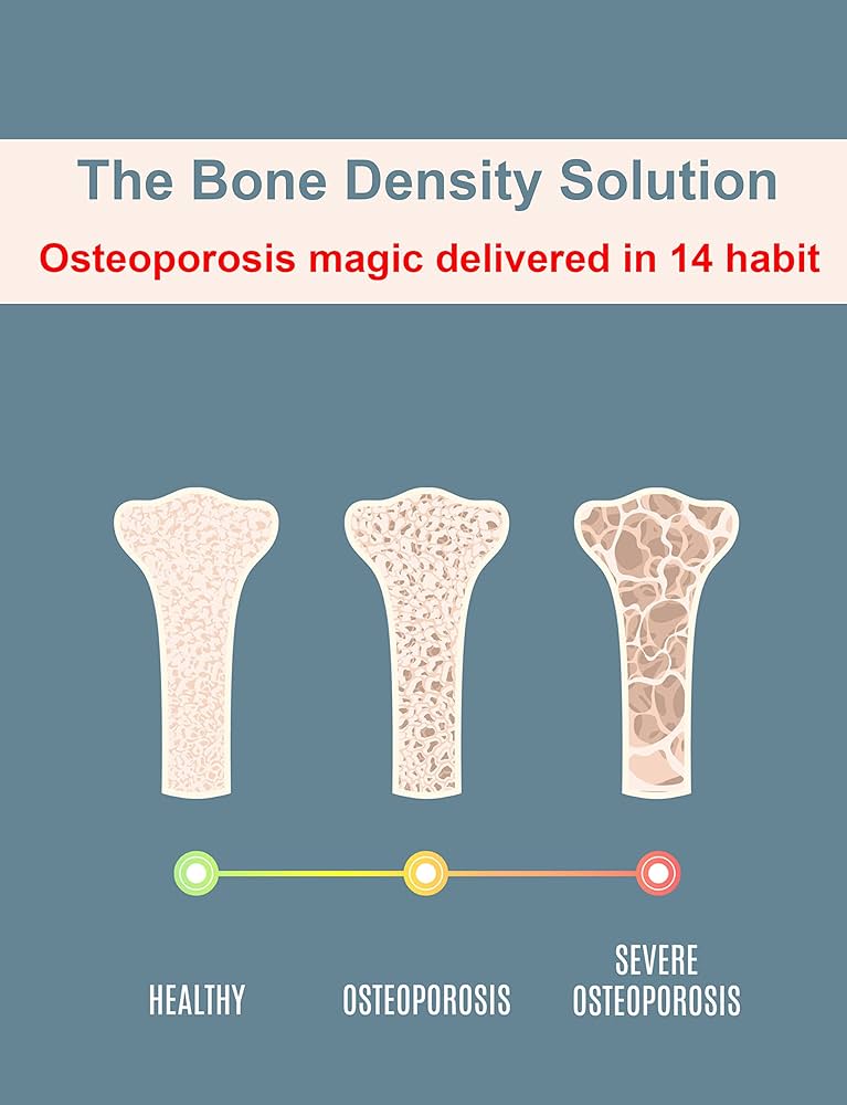 Osteoporosis - The Bone Density Solution pricing